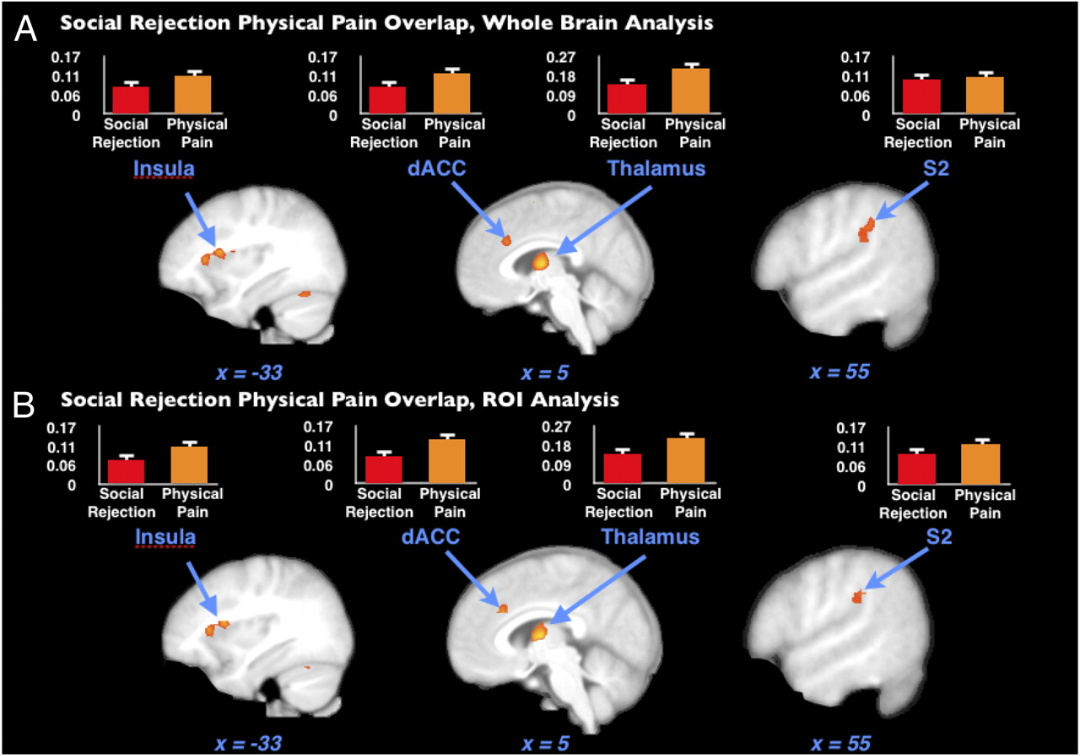 心痛的科学:被分手、被拒绝时为什么会让你感到疼痛? 心痛的科学:被分手、被拒绝时为什么会让你感到疼痛?